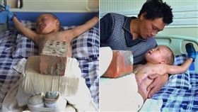5歲兒全身燒傷　父狠心拿30斤磚壓／翻攝畫面
（http://news.ifeng.com/a/20180414/57557819_0.shtml#p=13）