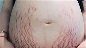 孕婦自卑妊娠紋不好看　老公這句「玩笑話」好暖
「爆怨公社」臉書