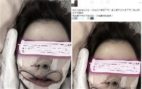 PO網抱怨牙齒矯正心路歷程　網友鼓勵：有勇氣的女生
（圖／翻攝自「爆怨公社」）