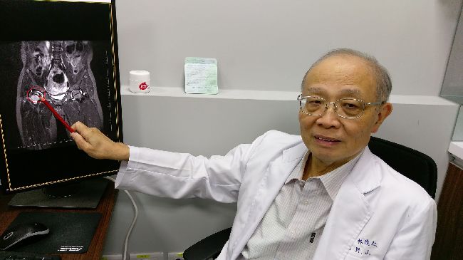 6歲童走路怪異　竟患先天性罕症