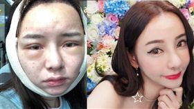 Kiwebaby,張朵,整形,韓國,藥物過敏,自拍／翻攝自臉書