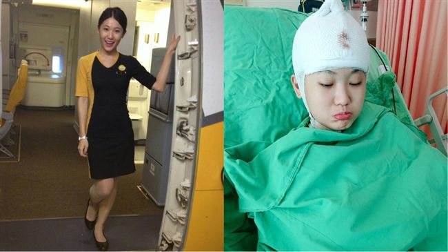 塵爆重傷　空姐：曾用馬桶水沖傷口