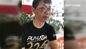 骨科名醫三鐵摔車 破相骨折控沒交管