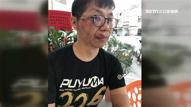 三鐵摔車手骨折　骨科名醫怒控沒交管