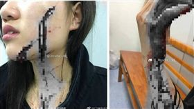 大陸貴陽省一名女網友「大琪」與一名女室友合租套房，上個月她的室友帶3位男生開趴，因為音量太大，她請他們小聲一點，不料慘被3位男生圍毆，甚至其中一名男子還拿菜刀亂砍，導致她的臉部及身上都有處刀傷。對此，警方表示案件還在調查中。（圖／翻攝自微博）