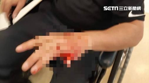 他遭油壓剪斷指　妻子：是為了救警察