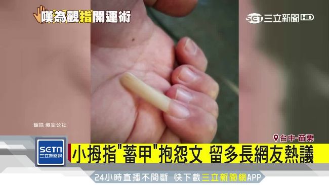 小拇指留超長指甲…他抱怨文釣出網友
