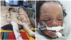 澳洲,Avery Beal,急性淋巴性白血病,抗癌,骨髓移植,葡萄球菌皮膚燙傷樣綜合症,露營,感染／Support for Avery's Journey 臉書