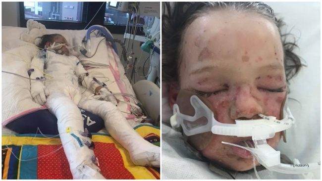4歲童慶祝抗癌成功　又感染罕病命危