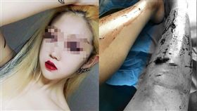 中國大陸女子控訴韓國遊學遭下藥性侵,但是是單戀倒追男不成,自殘逼對方（圖／微博）