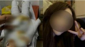 上廁所慘遭100度滾水淋全身…21歲小模全身燙傷命危　圖／翻攝自微博
