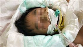 台中,大里,小六,顱骨,骨折,腳踏車,顱內出血（圖／翻攝畫面）