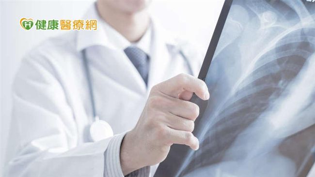 肺癌骨轉移不再忍痛！這治療重拾品質