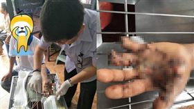 男子充電時接電話，結果手機爆炸把手炸斷。（圖／翻攝คนทำงาน ชายขอบ臉書）