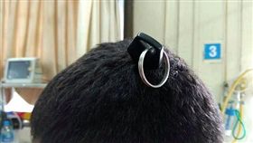 印度一名男子遭車鑰匙插腦，竟大難不死。（圖／翻攝騰訊網）