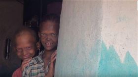 尖牙、扁鼻嚇壞村民！罕病兄弟被霸凌　家境貧困從未就醫（圖／翻攝自Rare Shot News CHANNEL YouTube）