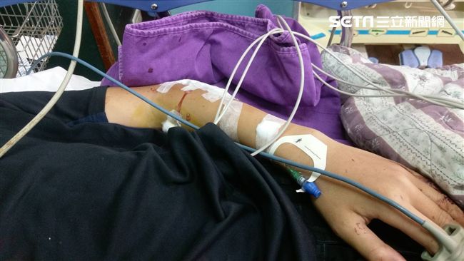 還車事宜爆口角　少年遭設伏痛毆成傷