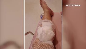 爛梯夾傷腿1200