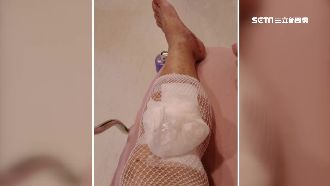 三義木雕街木梯腐壞　遊客腳卡洞骨折