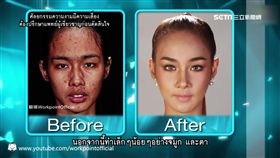 泰女因暴牙遭排擠 改造變身氣質正妹!