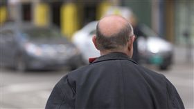 植髮,禿頭,韓國,光州,醫美,整形,掉髮,麻醉,手術,危險,解剖,暴斃,死亡,頭髮.頭皮 圖／翻攝自Pxhere　https://goo.gl/DkfhP9