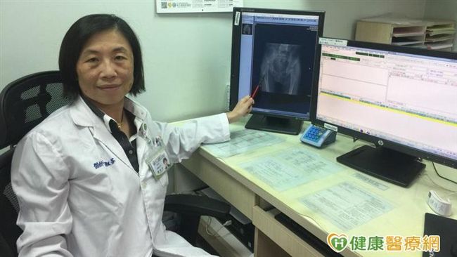 腦麻患受惠！肉毒桿菌素健保給付放寬