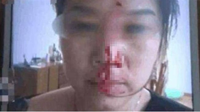 奧客嗆顧客就是上帝　慘遭外送員暴打