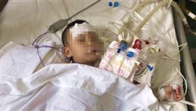 電蚊香,蚊香液,中毒,洗胃,男童,中國大陸（圖／翻攝自微博）