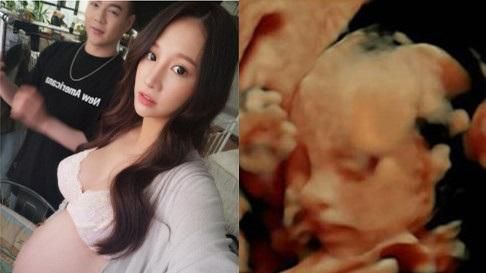 林采緹提前慶生　兒子乾媽：就是今天