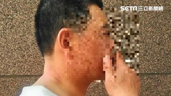 一天一根菸　罹患心臟病機率多5成7