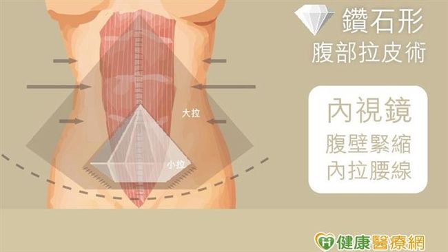 小腹鬆垮垮？這招讓媽咪重拾產前光彩