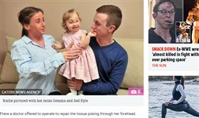 奇蹟！出生時「腦外露」　女嬰1歲了 
英國,罕見疾病,奇蹟,腦膨出,畸形,腦脊液,母愛 https://www.thesun.co.uk/fabulous/6358147/toddler-born-brain-outside-skull-20-minutes-live/