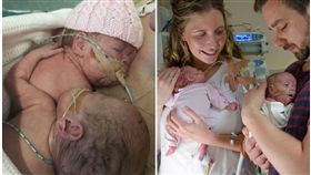 英國雙胞胎早產兒夏綠蒂（Charlotte）和艾絲梅（Esme）／This is my brave face 臉書