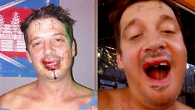 柬埔寨,度假,羅翰,Paul Farrell,Sihanouk,工作,酒吧,圍毆,毆打,刺青,臺灣,牙齒　圖／翻攝自Taiwan News　https://goo.gl/beXf18