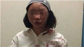 拒絕司機拉客　女大生慘遭撞飛暴打縫6針　圖／翻攝澎湃新聞