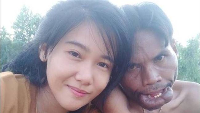 清秀正妹嫁醜男　被爆剛結婚就分居