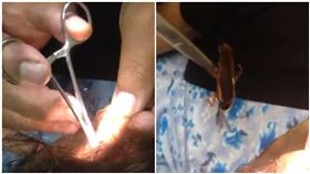 蟑螂、耳朵、噁心、挖（圖／翻攝自推特 WilliamFlashito）