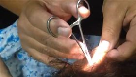 蟑螂、耳朵、噁心、挖（圖／翻攝自推特 WilliamFlashito）