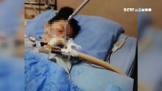 做醫美手術竟昏迷　家屬控診所疏失