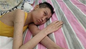 河南安陽22歲趙晴得血癌，父親怕死拒絕捐骨髓。（圖／翻攝自騰訊新聞）