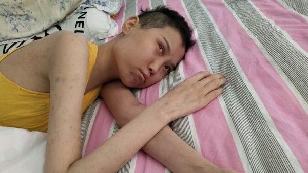 血癌女昏迷求骨髓　父拒絕：死也不捐