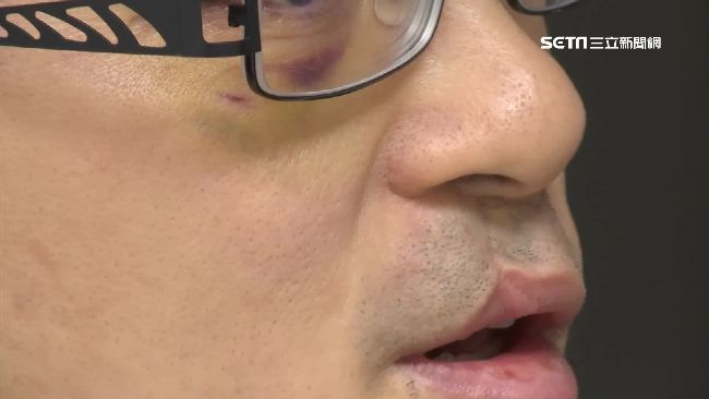 誤認控管不當　住戶教唆惡煞痛毆保全