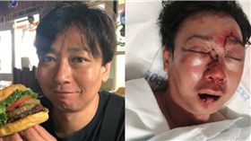 上公廁被打成豬頭　日夫婦夏威夷旅遊成惡夢！　圖／翻攝自ｋｈｏｎ２