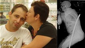 鋼條,鐵條,英國,貫穿,大腿,Daniel de Wet,Carletonville,金礦,工作,超馬　圖／翻攝自臉書