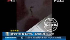 被蜈蚣咬▲（圖／翻攝自新浪網）　