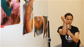 宣布引退　許淑淨高雄說明原因（2）台灣兩屆舉重奧運金牌女將許淑淨3日透過臉書宣布引退，震驚體壇，許淑淨4日親自在高雄出席記者會，展示手肘傷勢及治療過程照片，詳細說明決心引退原因。中央社記者董俊志攝　107年6月4日