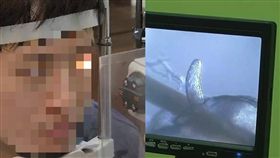 眼睫毛有蟎蟲寄生／資料照、看看新聞