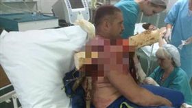 男手臂被插入粗大樹幹竟沒感覺。（圖／翻攝The Sun）