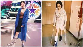 Albee,復健,綜藝玩很大,外景,骨折,深蹲,打石膏／Albee IG