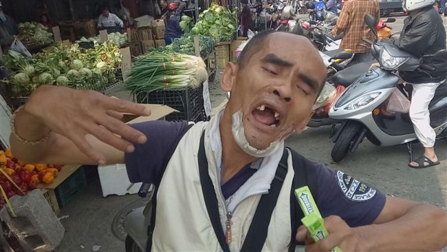 小兒麻痺男街賣　全身顫抖向客人道謝